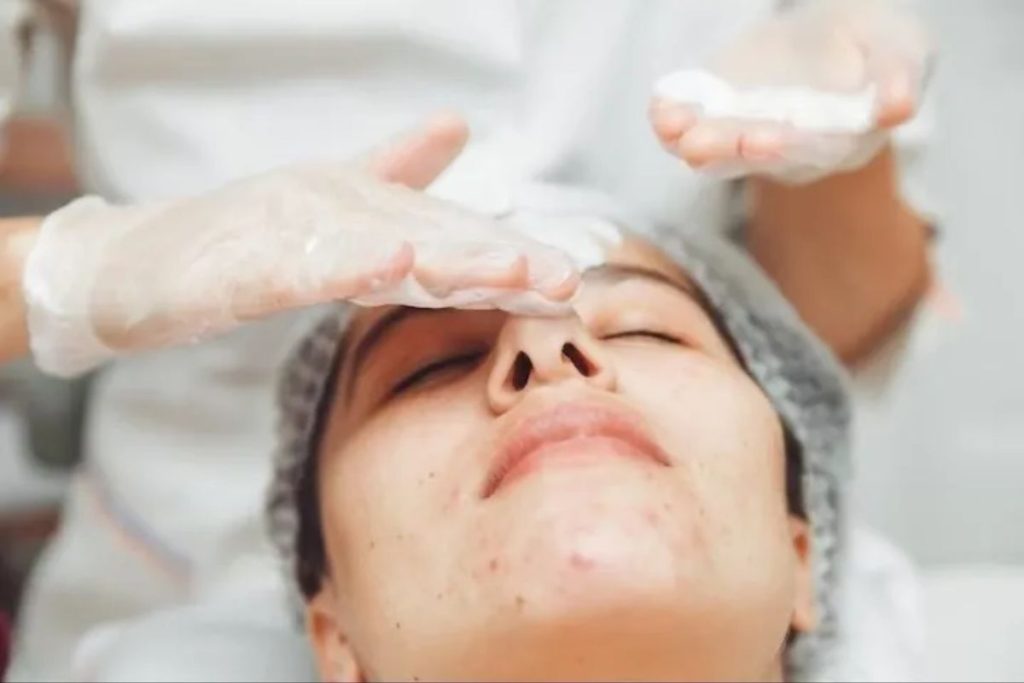 acne facial schedule treatment plan consultation Florence KY